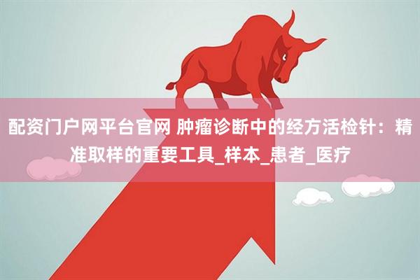 配资门户网平台官网 肿瘤诊断中的经方活检针：精准取样的重要工具_样本_患者_医疗